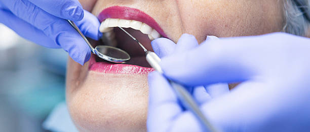 Best Emergency Dental Care for Sports Injuries in Prices Fork, VA